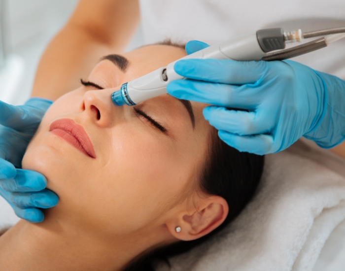 HydraFacial for Acne and Oily Skin | Benefits & Results