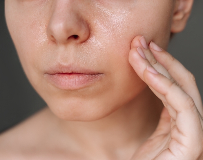 Oily Skin and Enlarged Pores Treatment: What Works Best